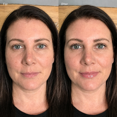 Brightskin LipGlow™ – leppebalm med personlig fargetone