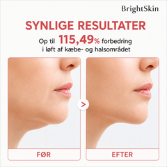 Brightskin V-Lift™ – kølende ansigtsbånd til en mere defineret kæbelinje, 4-pak